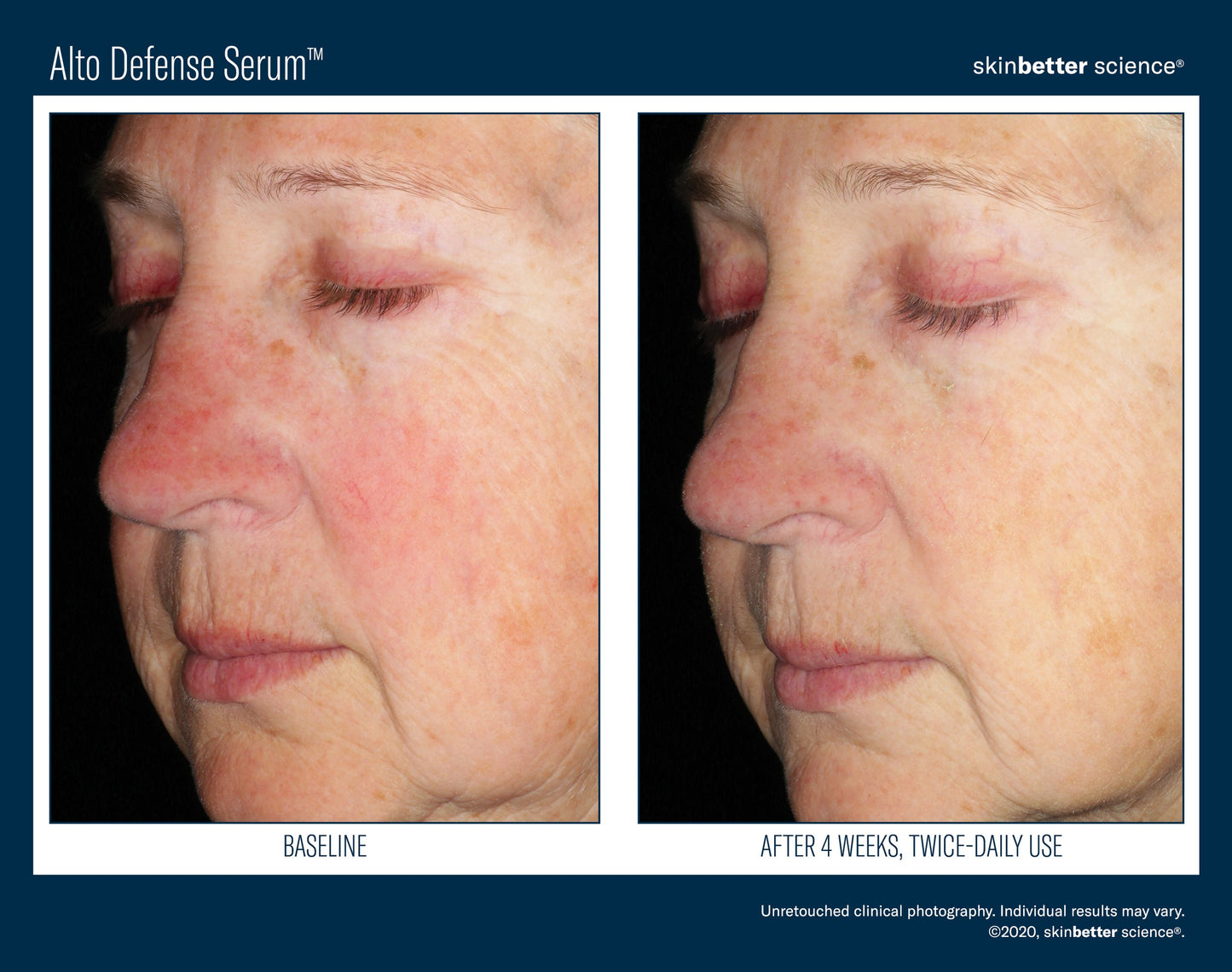 Skinbetter - Alto Advanced Defense and Repair Serum - 0.5 fl.oz. - TRAVEL