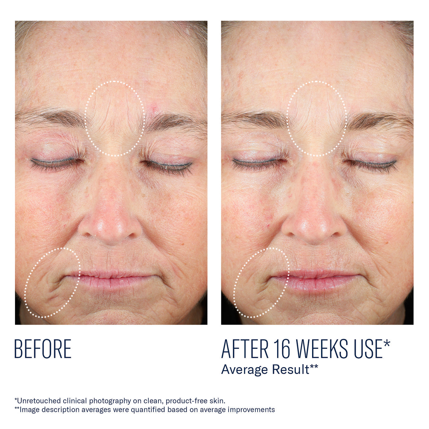 Skinbetter Mystro Revive Renewing Serum - 1.0 fl. oz