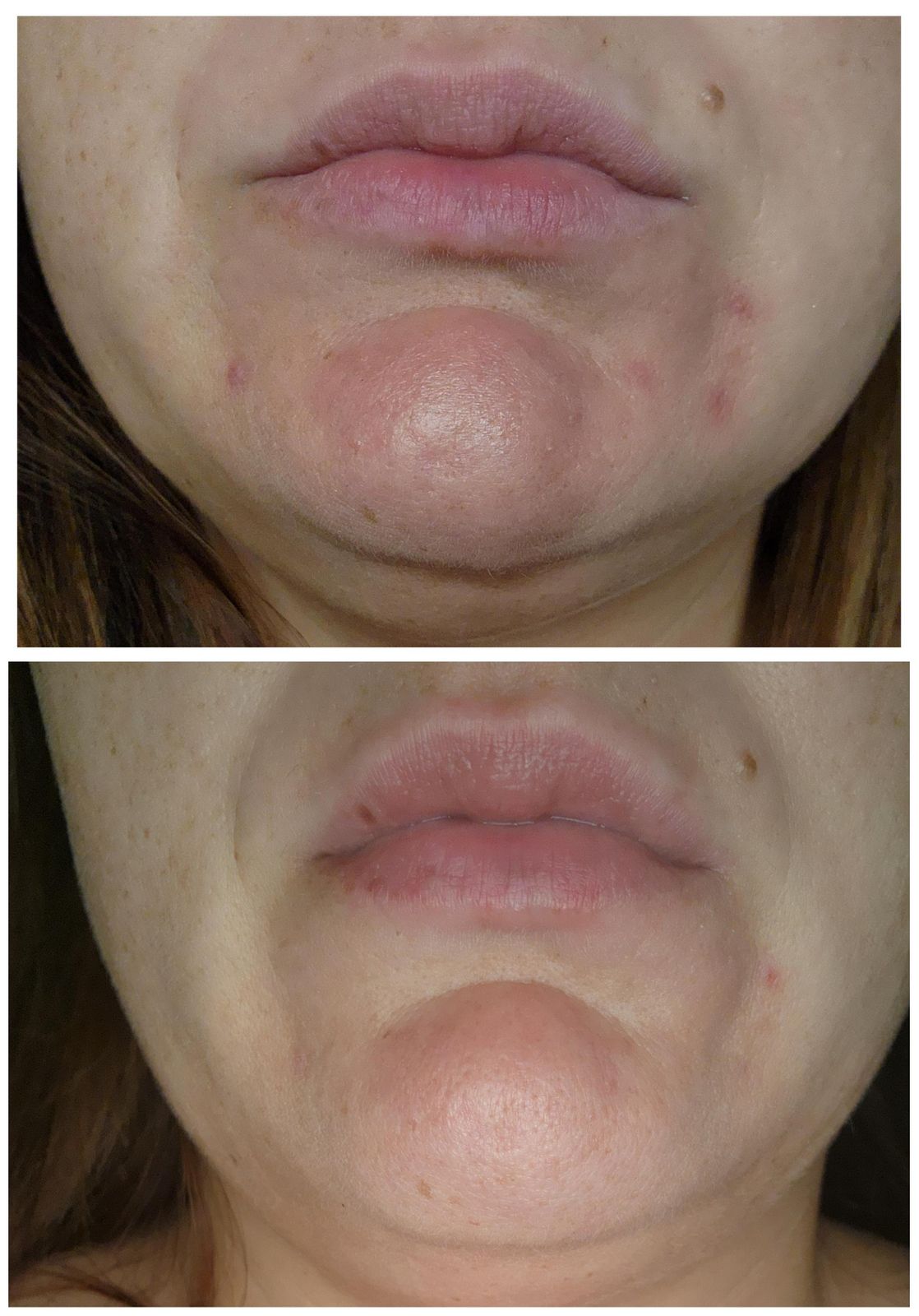 AN SKIN - Oil Control Foamy Cleanser