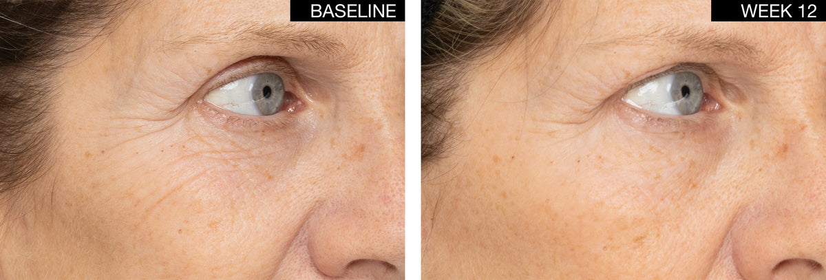 AN SKIN - ExoEssence Peptide Serum