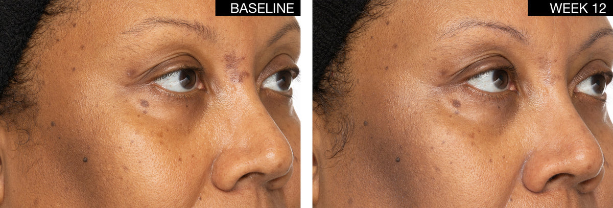 AN SKIN - ExoEssence Peptide Serum