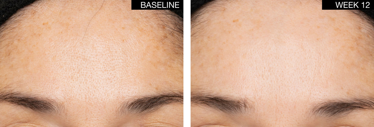 AN SKIN - ExoEssence Peptide Serum