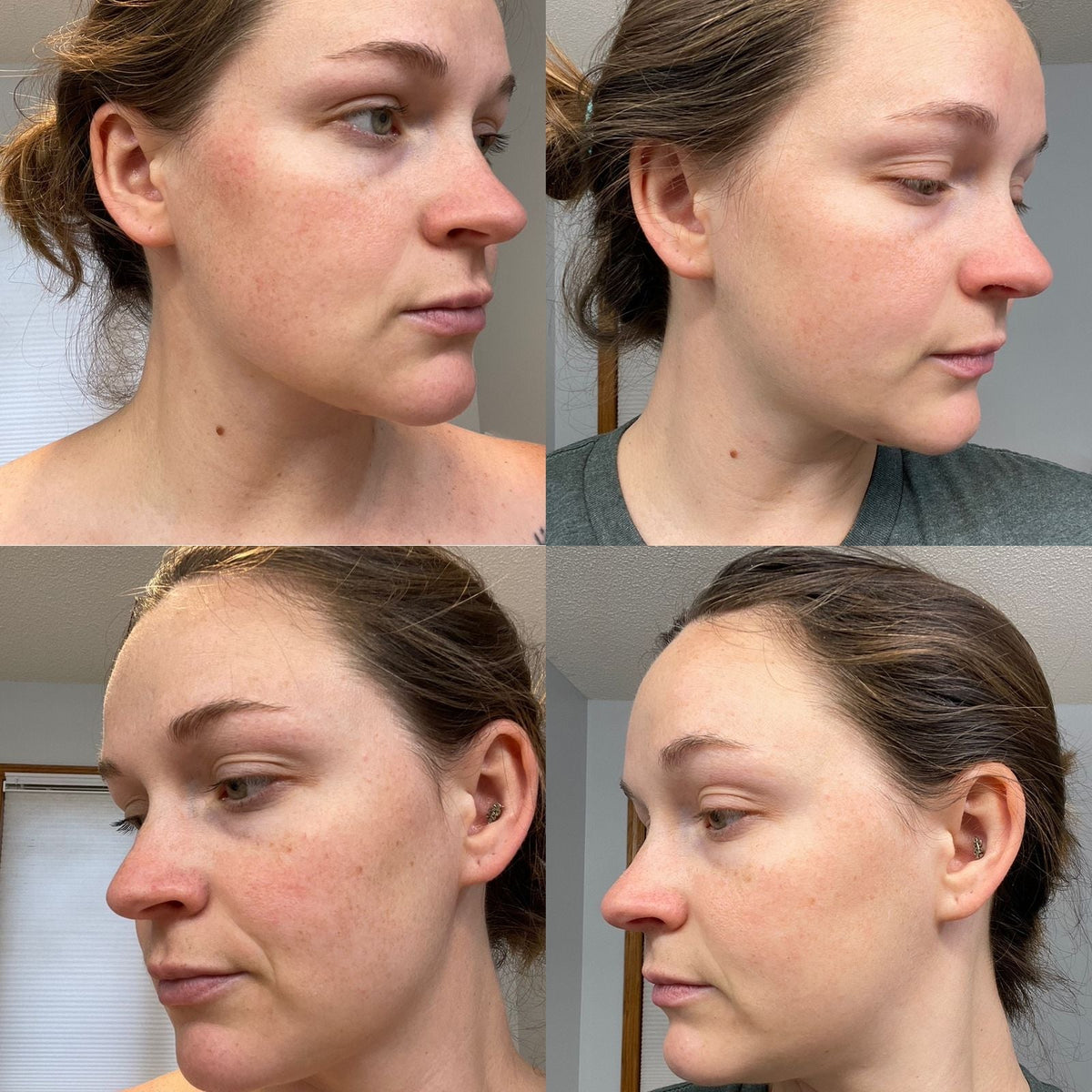 AN SKIN - Chlorophyll Correction Serum