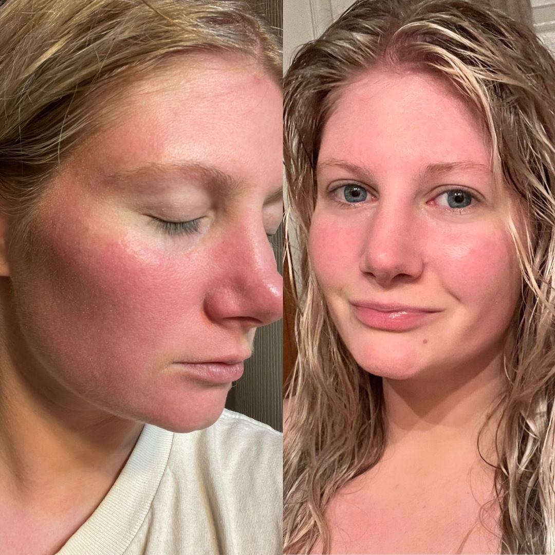 AN SKIN - Chlorophyll Correction Serum