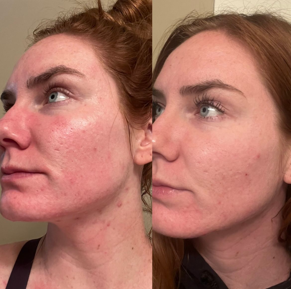 AN SKIN - Chlorophyll Correction Serum