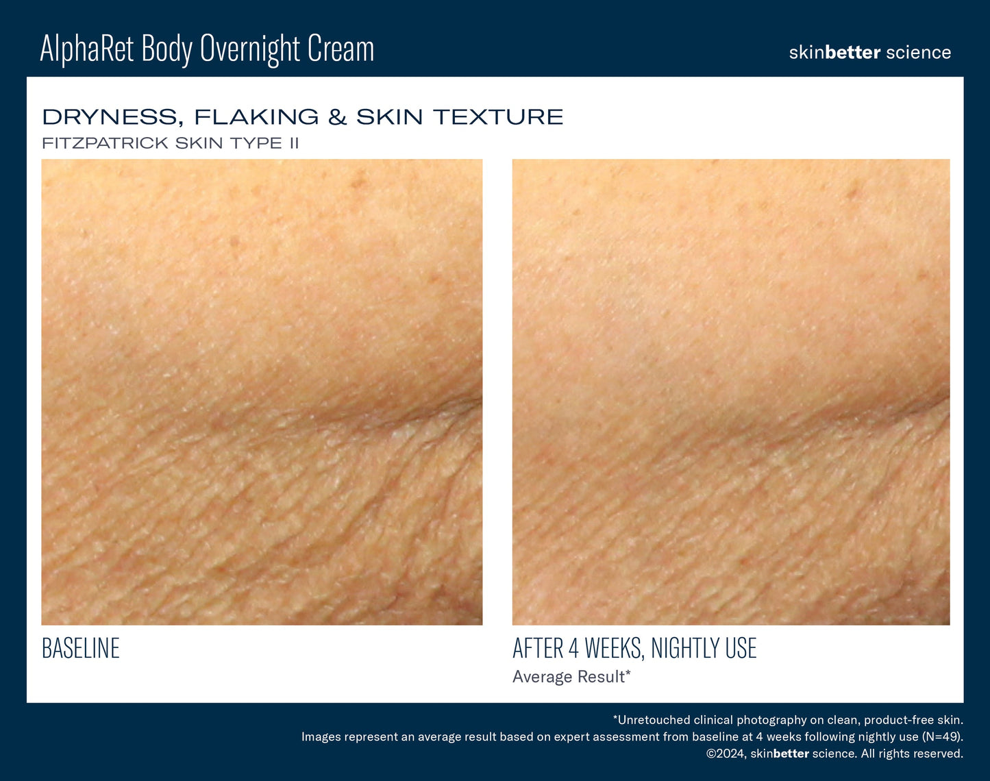 Skinbetter - Alpharet Body Overnight Cream - 0.5 fl. oz. - TRAVEL