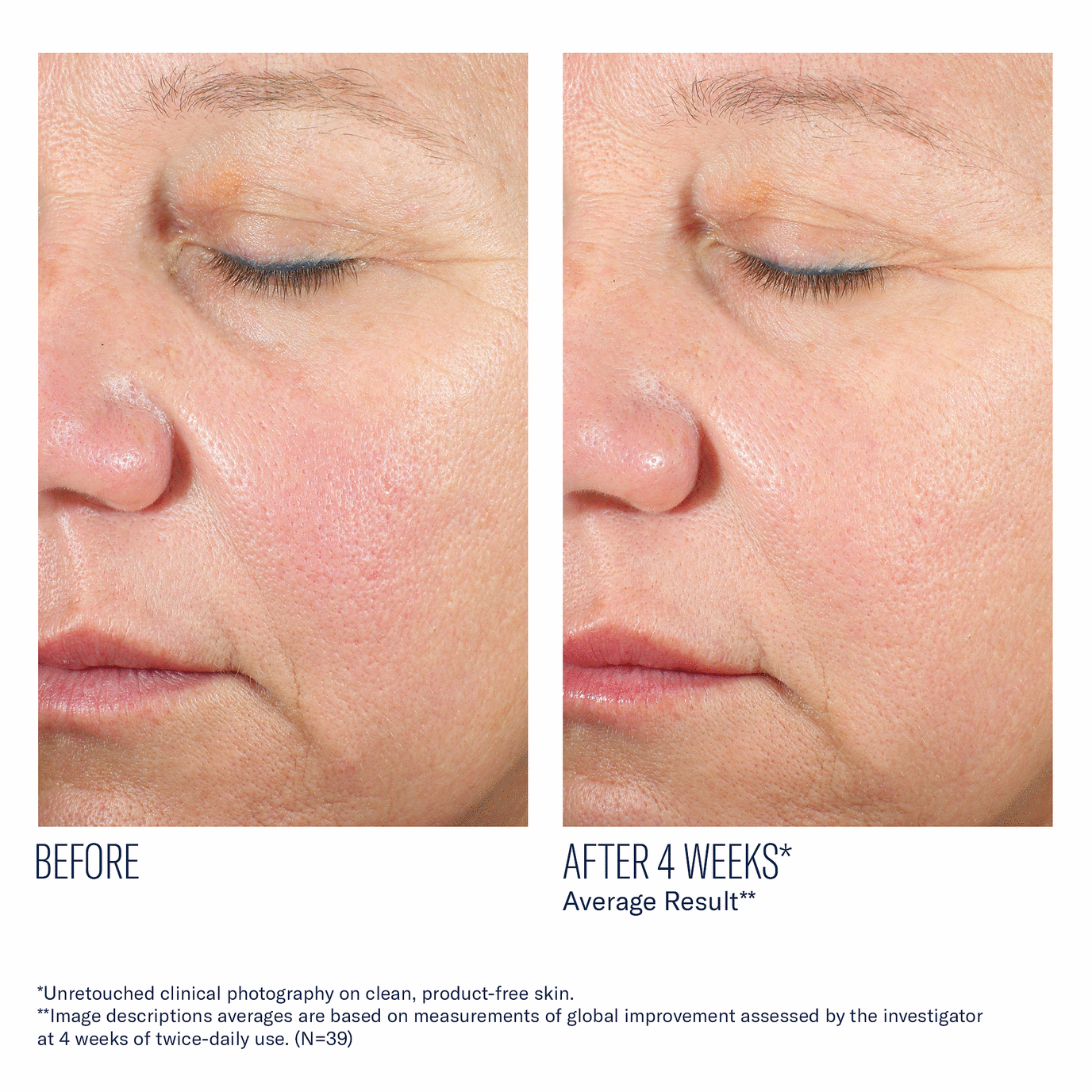 Skinbetter - Alto Advanced Defense and Repair Serum - 1.0 fl. oz.
