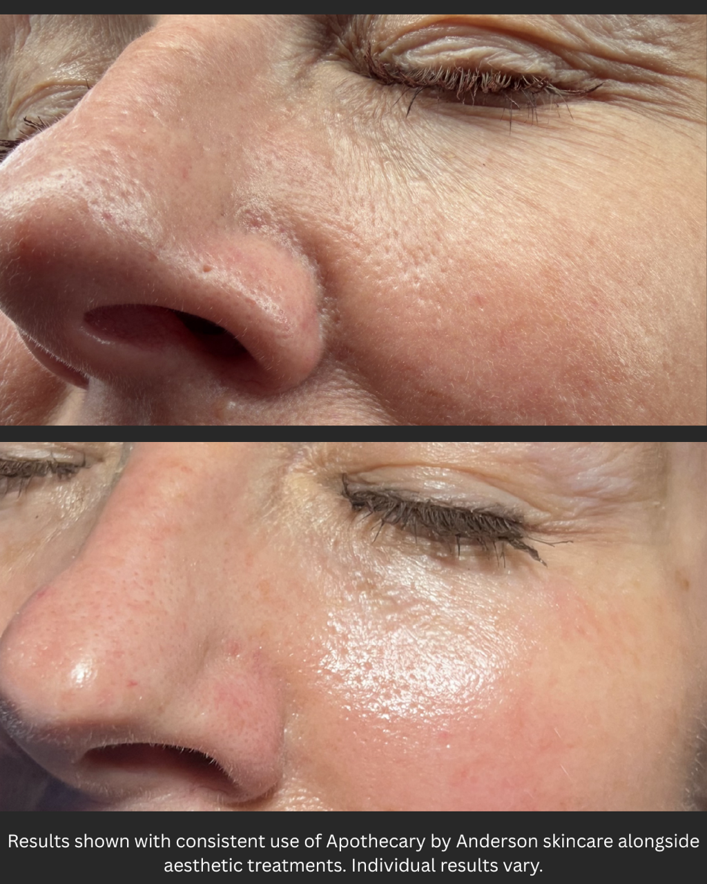 Apothecary by Anderson - Radiance Regimen Signature - 4 Product Kit