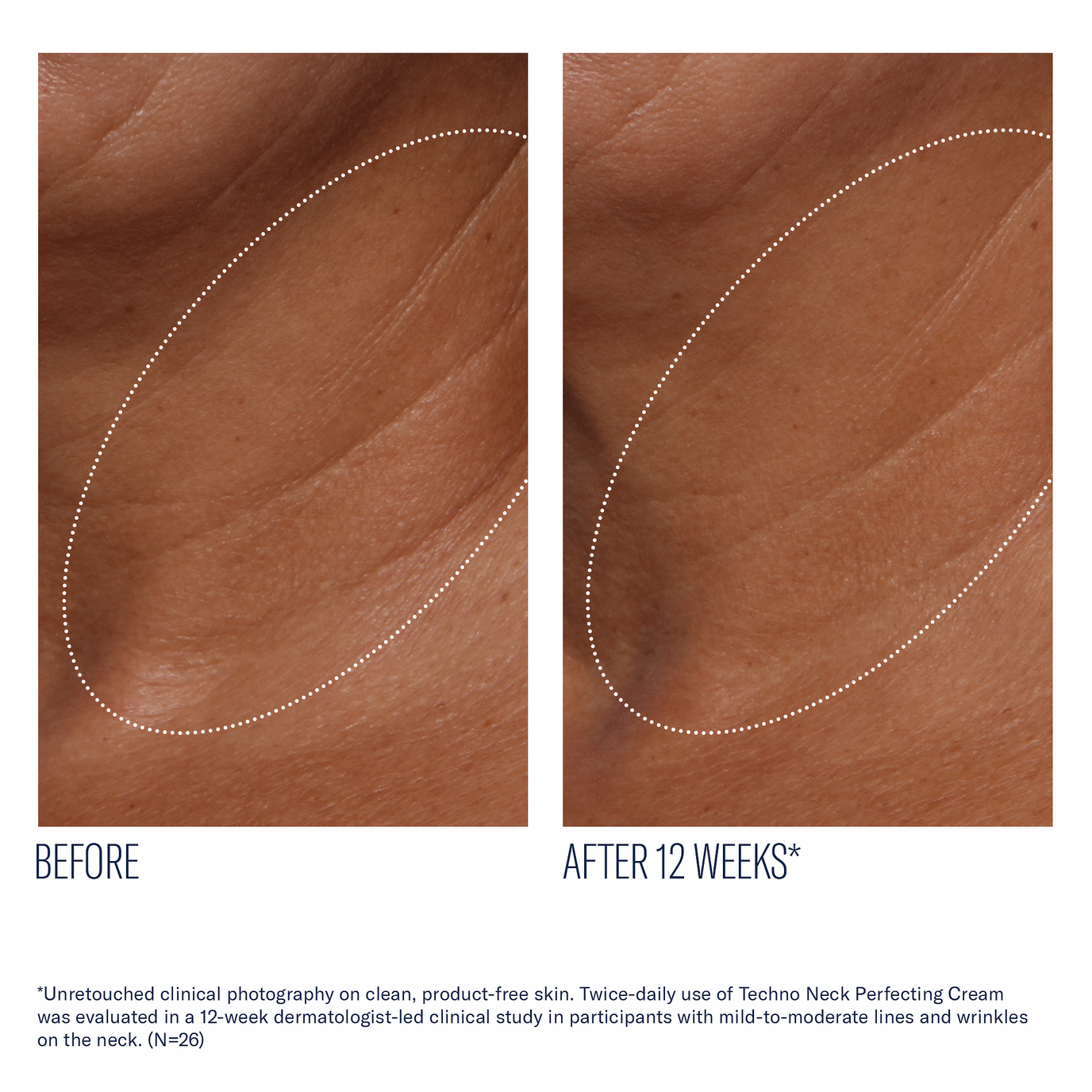 Skinbetter - Techno-Neck - 1.7 fl. oz.