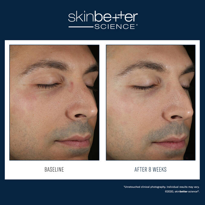 Skinbetter - Solo Hydrating Defense Men - 1.7oz