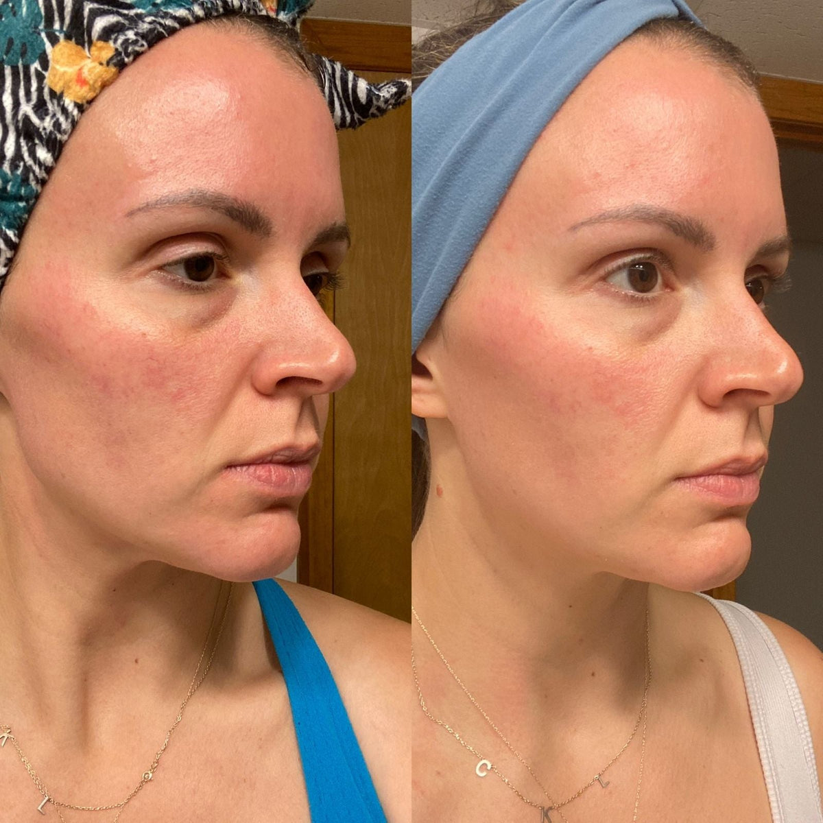 AN SKIN - Chlorophyll Correction Serum