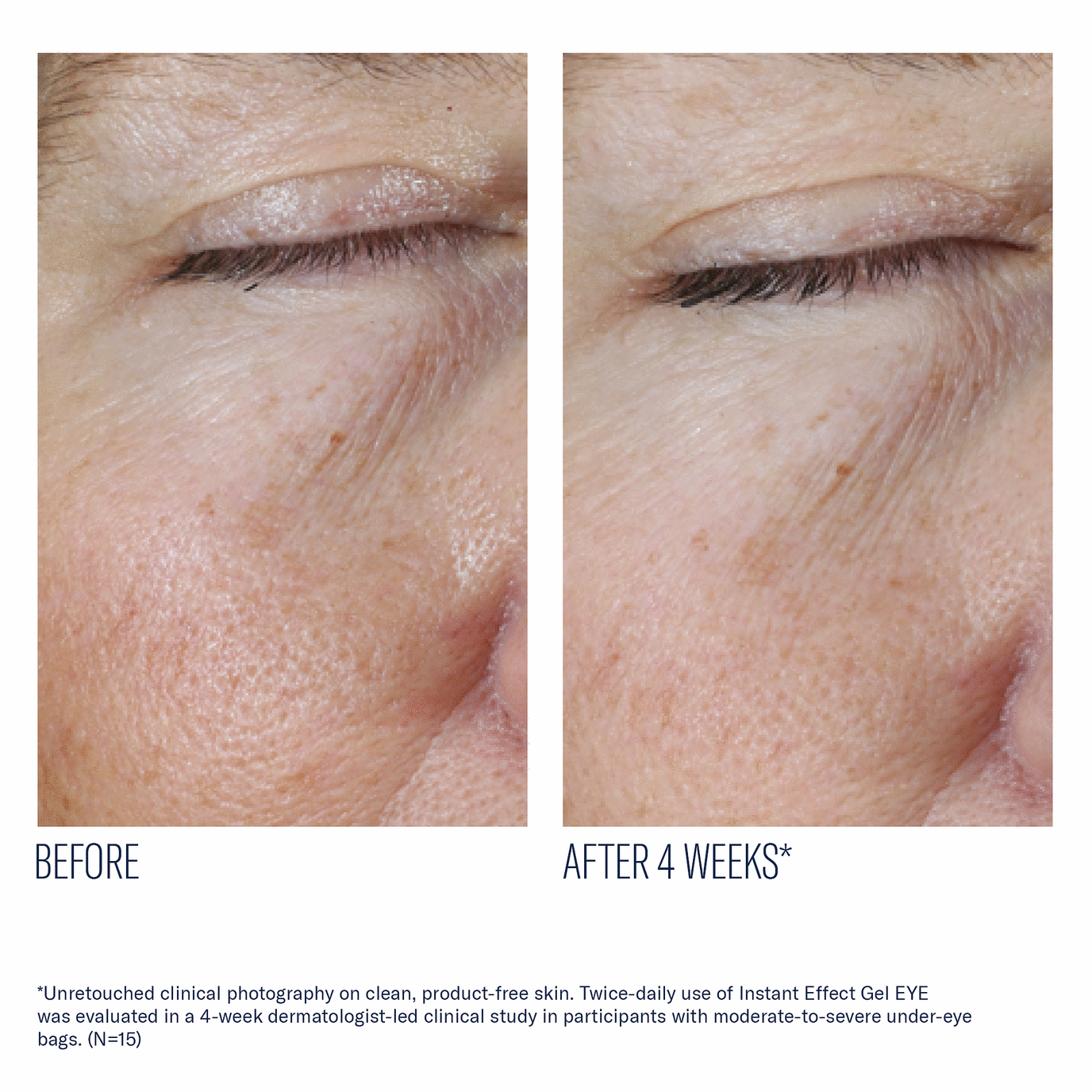 Skinbetter - Instant Effect Eye Gel - 0.5 fl. oz.